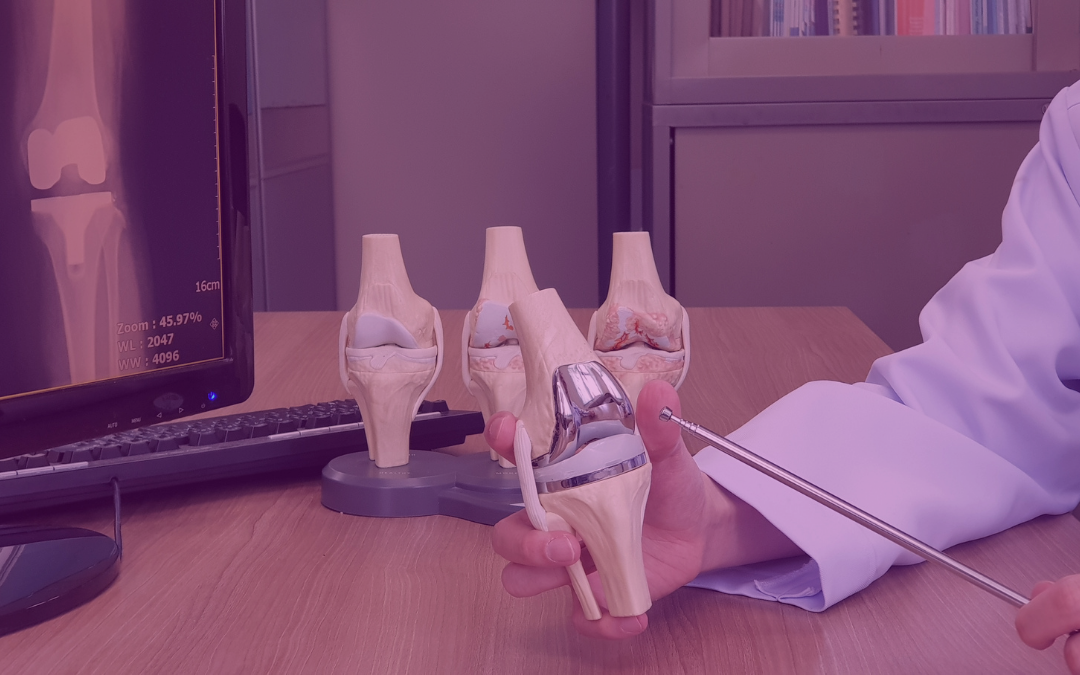 CASE4Med-lebensdauersimulation lebensdauersimulation